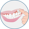 la pastille Xilimelts se colle naturellement à vos dents